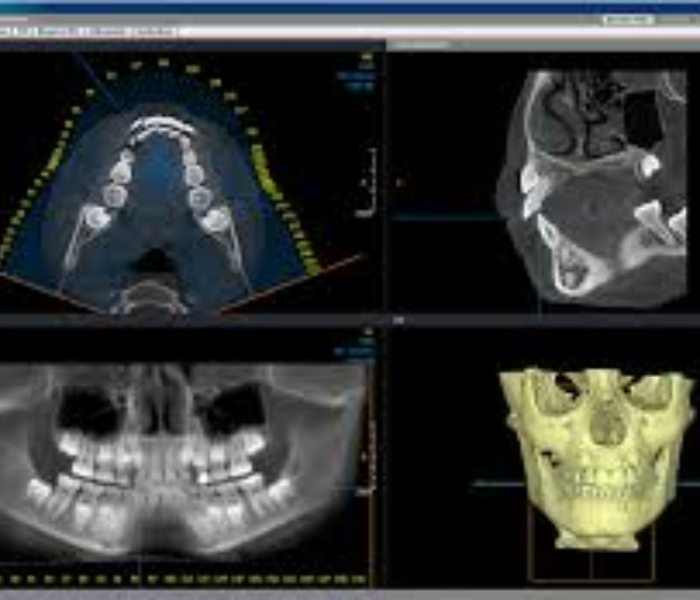 CBCT Dental Scan